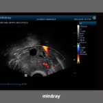 Sistemas de radiología