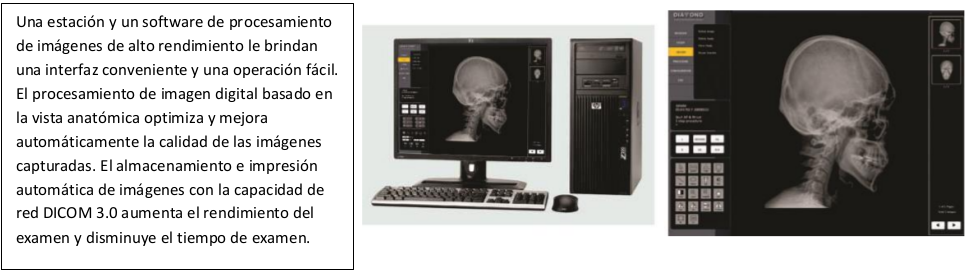 software de procesamiento de imágenes de rayos x