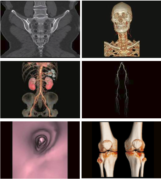 Imagenes clinicas Tomografo ANATOM 16HD