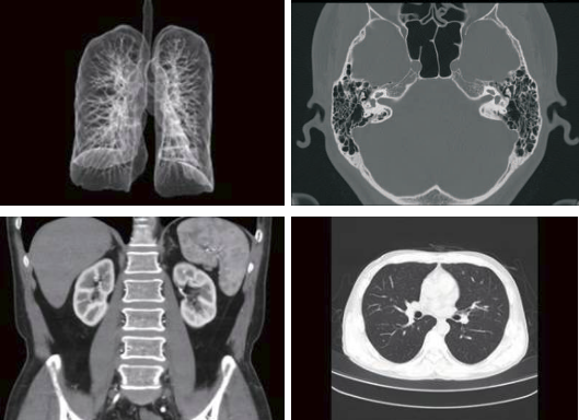 Imagenes clinicas de ANATOM 16HD