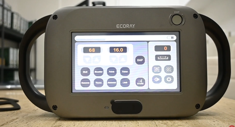 Guía 2024: Ecoray Mini-90 el mejor equipo de rayos X portátil