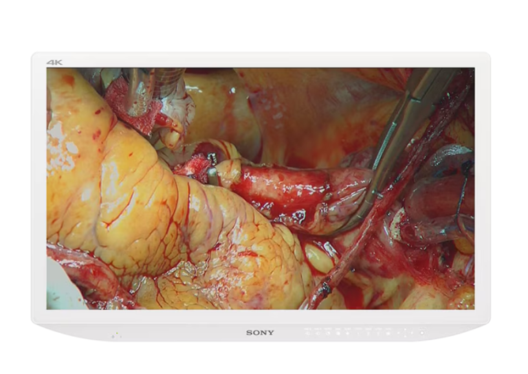 Monitor Médico Sony LMD-X3200MD 32" 4K: Imagen HDR y Claridad Quirúrgica